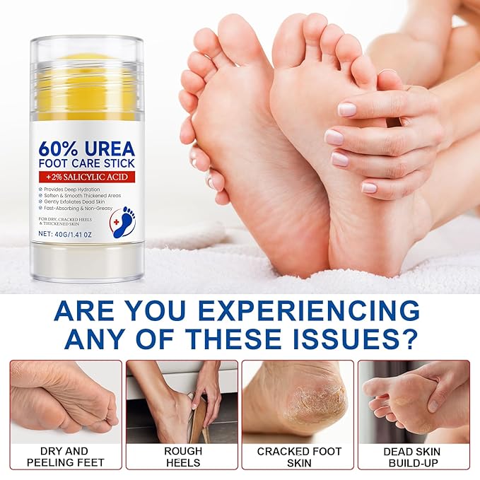 60% Urea Cream Stick with 2% Salicylic Acid - Maximum Strength Urea Foot Care Stick, Foot Cream, Foot Balm for Dry Cracked Heels, Callus Treatment, Moisturizer for Hands, Elbows & Knees - 1.4OZ