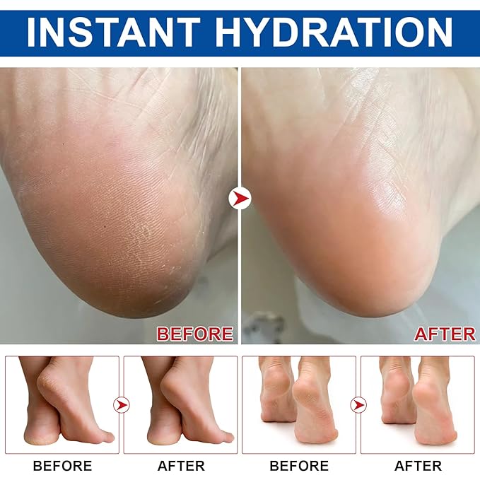 60% Urea Cream Stick with 2% Salicylic Acid - Maximum Strength Urea Foot Care Stick, Foot Cream, Foot Balm for Dry Cracked Heels, Callus Treatment, Moisturizer for Hands, Elbows & Knees - 1.4OZ