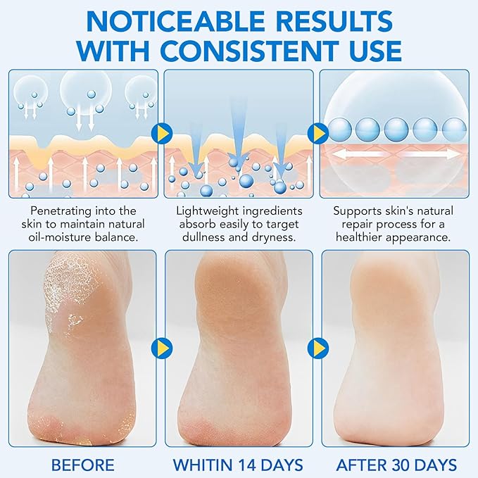 Urea Foot Cream Stick, 60% Urea Cream with 2% Salicylic Acid Foot Care Stick Moisturizer for Dry Cracked Heels, Knees, Hands, Moisturizes & Hydrates Dry Skin, Callus Remover & Skin Softener 1.41 oz