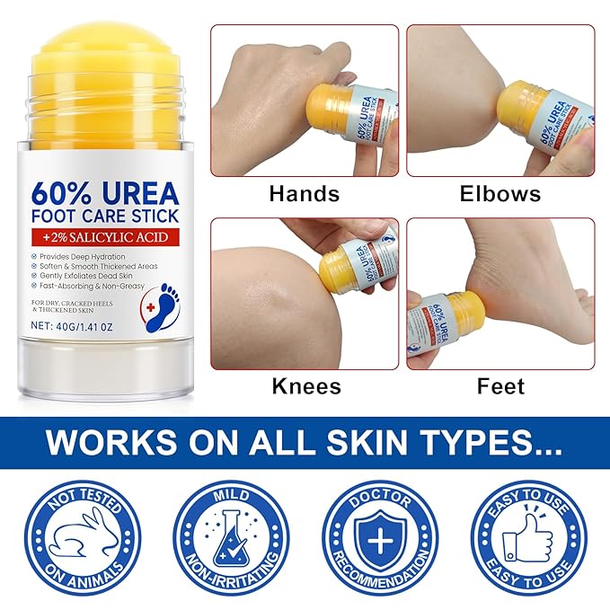60% Urea Cream Stick with 2% Salicylic Acid - Maximum Strength Urea Foot Care Stick, Foot Cream, Foot Balm for Dry Cracked Heels, Callus Treatment, Moisturizer for Hands, Elbows & Knees - 1.4OZ