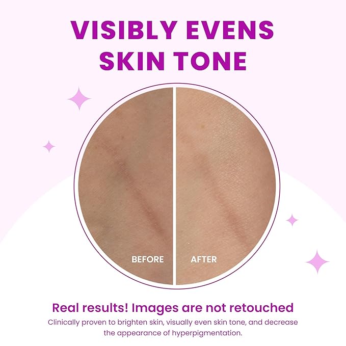 Lume Acidified Body Wash - 24 Hour Odor Control - Removes Odor Better than Soap - Moisturizing Formula - Formulated Without SLS or Parabens - OB/GYN Developed - 8.5 ounce (Pack of 2) (Unscented)