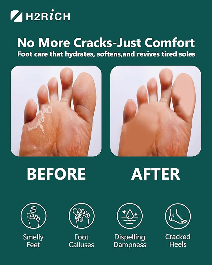 Hydrogen Foot Soak Effervescent Tablets 6 Pack | Ginger & Mugwort Herb Foot Bath, Relaxing Spa Pedicure Care | Improves Circulation, Soothes Tired Feet, Softens Calluses, Controls Odor