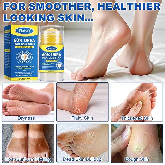 60% Urea Cream Stick with Salicylic Acid 2%, Urea Hydrating Foot Cream, Severe Cracked Heel Repair Restoring Balm, Foot Lotion Repairs and Hydrates Dry and Feet and Hand - 2 Packs